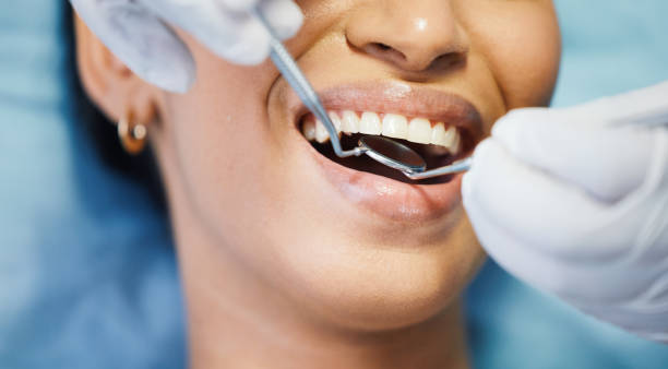 Best Emergency Treatment for Toothache in Pascoag, RI
